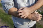 مولکول عامل درد و خارش پوست شناسایی شد